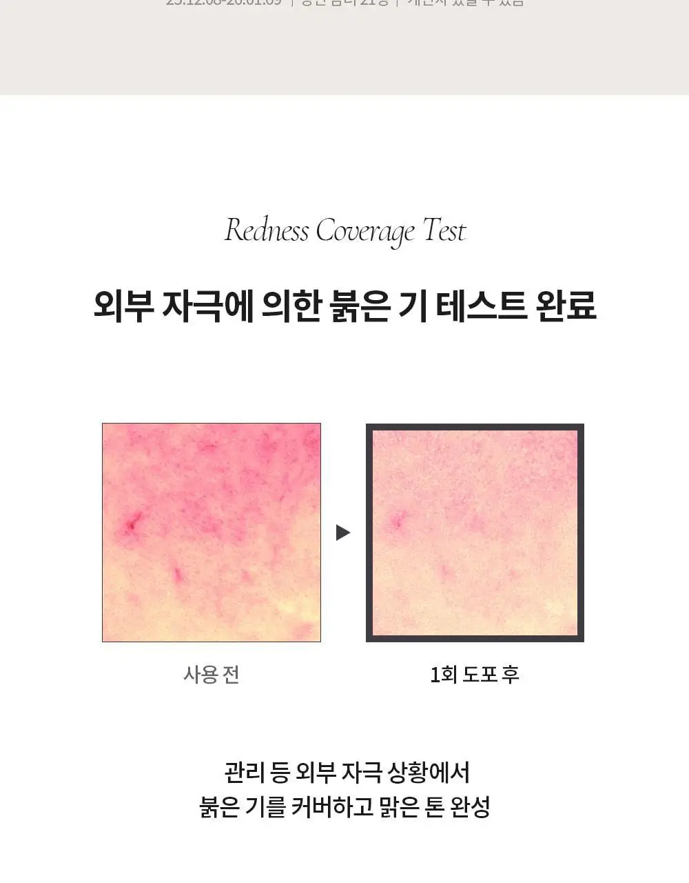 [NEW 뉴트럴 소프트 베이지] 피몽쉐 아쿠아 블레미쉬 커버 밤 20ml 상세페이지 29
